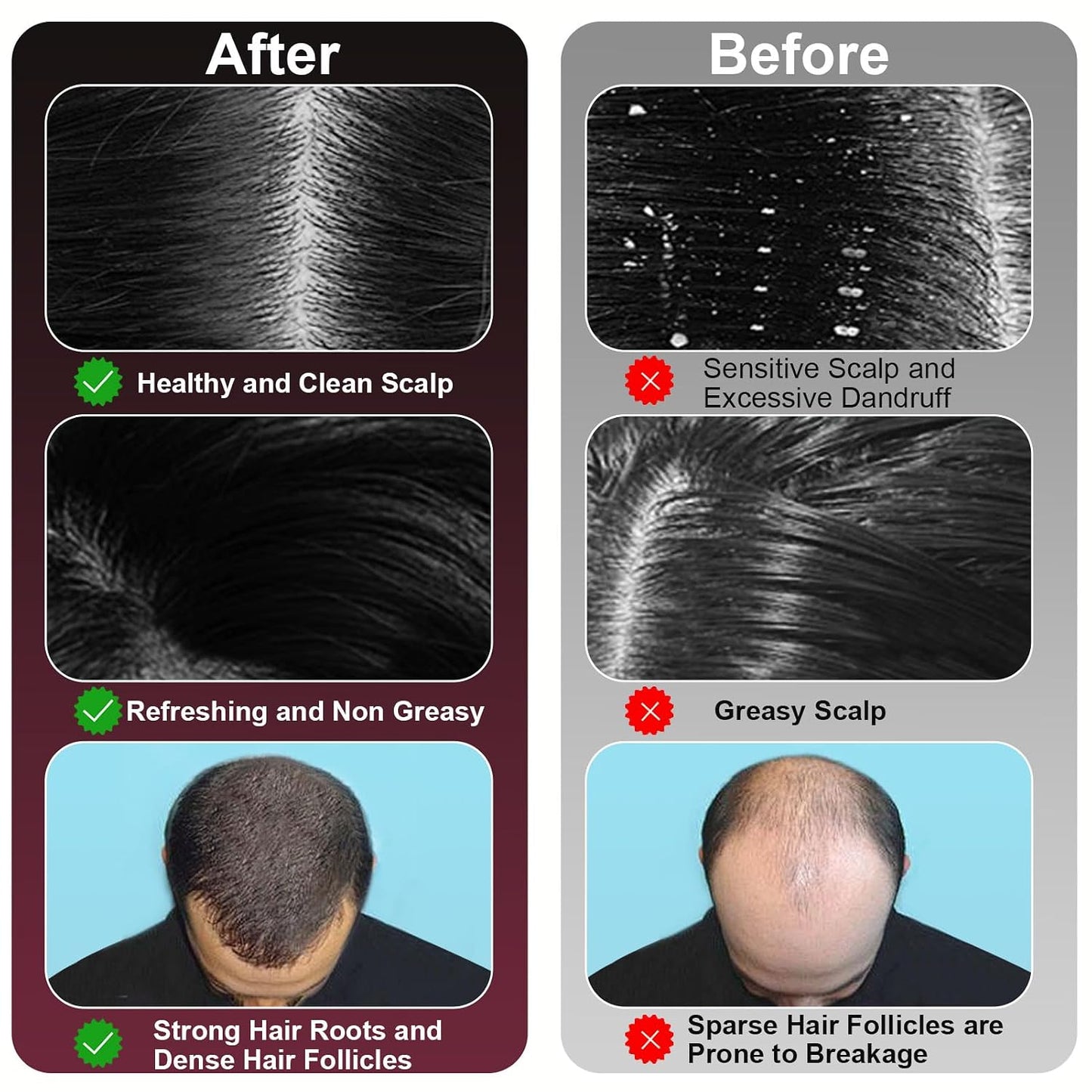 Advanced Red Light Scalp Revitalizer™